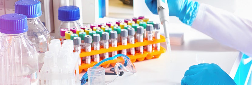 硝酸釷檢測(cè)