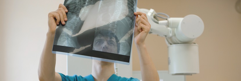 移動(dòng)CR放射衛(wèi)生檢測評(píng)價(jià)