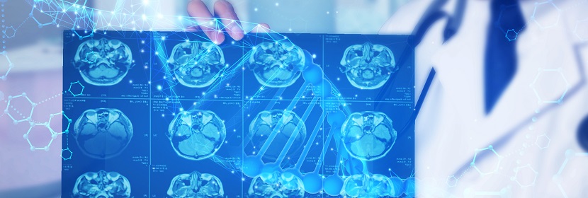 DSA(數(shù)字減影血管造影)放射衛(wèi)生檢測(cè)評(píng)價(jià)